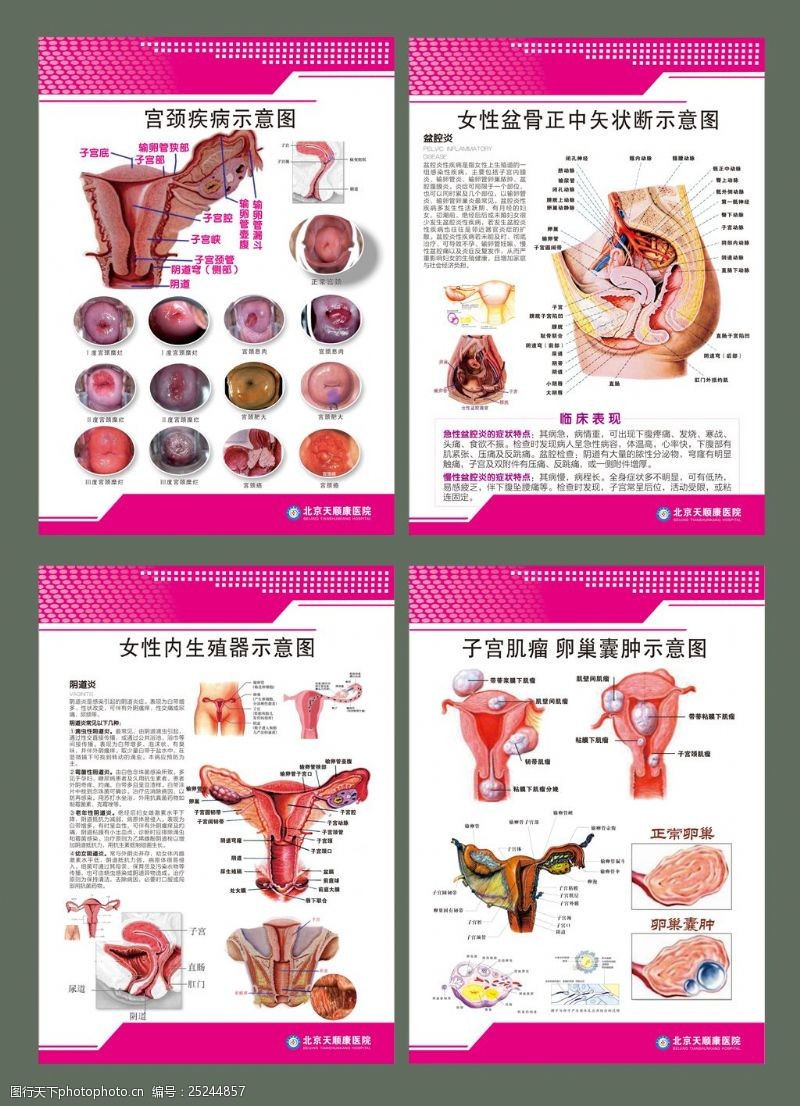 生殖系统图女性生殖系统挂图
